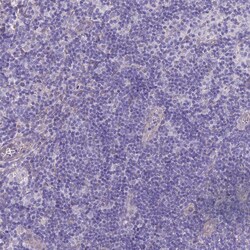 Invitrogen PGM1 Polyclonal Antibody 100 &mu;L; Unconjugated:Antibodies,