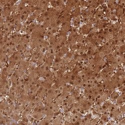 Invitrogen PGM1 Polyclonal Antibody 100 &mu;L; Unconjugated:Antibodies,