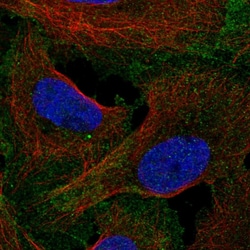 Invitrogen LRRC69 Polyclonal Antibody 100 &mu;L; Unconjugated:Antibodies,