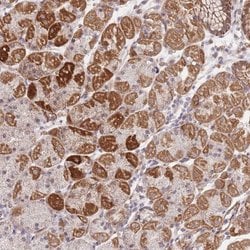 Invitrogen MRPS31 Polyclonal Antibody 100 &mu;L; Unconjugated:Antibodies,