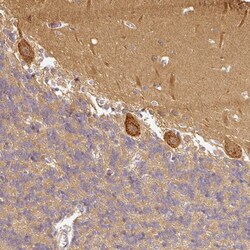 Invitrogen ANKRD18A Polyclonal Antibody 100 &mu;L; Unconjugated:Antibodies,