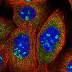 Invitrogen ANKRD18A Polyclonal Antibody 100 &mu;L; Unconjugated:Antibodies,