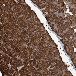 Invitrogen RFPL4A Polyclonal Antibody 100 &mu;L; Unconjugated:Antibodies,