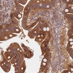 Invitrogen DDX19B Polyclonal Antibody 100 &mu;L; Unconjugated:Antibodies,
