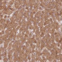 Invitrogen DDX19B Polyclonal Antibody 100 &mu;L; Unconjugated:Antibodies,