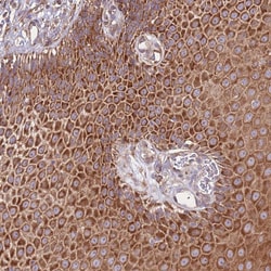 Invitrogen DDX19B Polyclonal Antibody 100 &mu;L; Unconjugated:Antibodies,