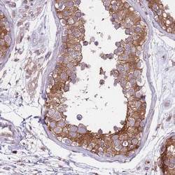 Invitrogen DDX19B Polyclonal Antibody 100 &mu;L; Unconjugated:Antibodies,