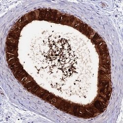 Invitrogen DEFB132 Polyclonal Antibody 100 &mu;L; Unconjugated:Antibodies,