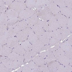 Invitrogen NALP11 Polyclonal Antibody 100 &mu;L; Unconjugated:Antibodies,