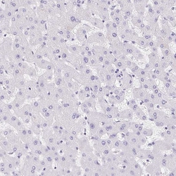 Invitrogen REG4 Polyclonal Antibody 100 &mu;L; Unconjugated:Antibodies,