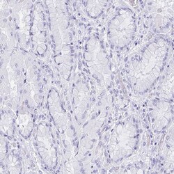 Invitrogen REG4 Polyclonal Antibody 100 &mu;L; Unconjugated:Antibodies,