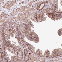 Invitrogen NDUFAF4 Polyclonal Antibody 100 &mu;L; Unconjugated:Antibodies,