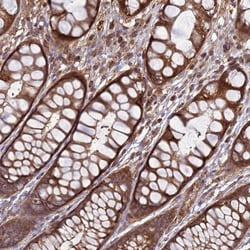 Invitrogen CNOT1 Polyclonal Antibody 100 &mu;L; Unconjugated:Antibodies,