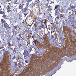Invitrogen CNOT1 Polyclonal Antibody 100 &mu;L; Unconjugated:Antibodies,