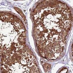 Invitrogen CNOT1 Polyclonal Antibody 100 &mu;L; Unconjugated:Antibodies,