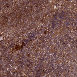 Invitrogen CNOT1 Polyclonal Antibody 100 &mu;L; Unconjugated:Antibodies,