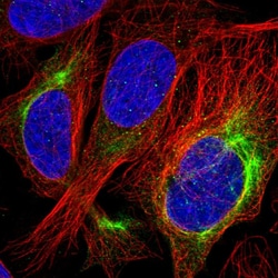 Invitrogen Alsin Polyclonal Antibody 100 &mu;L; Unconjugated:Antibodies,