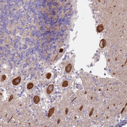 Invitrogen Alsin Polyclonal Antibody 100 &mu;L; Unconjugated:Antibodies,