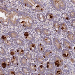 Invitrogen Alsin Polyclonal Antibody 100 &mu;L; Unconjugated:Antibodies,