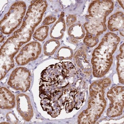 Invitrogen Alsin Polyclonal Antibody 100 &mu;L; Unconjugated:Antibodies,