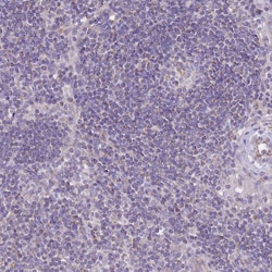 Invitrogen Alsin Polyclonal Antibody 100 &mu;L; Unconjugated:Antibodies,