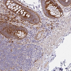 Invitrogen SGK494 Polyclonal Antibody 100 &mu;L; Unconjugated:Antibodies,