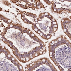 Invitrogen Calpain 7 Polyclonal Antibody 100 &mu;L; Unconjugated:Antibodies,