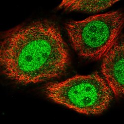 Invitrogen BRMS1L Polyclonal Antibody 100 &mu;L; Unconjugated:Antibodies,