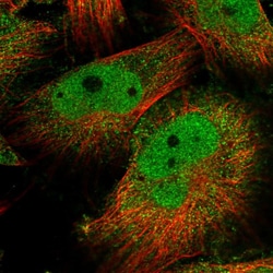 ZNF776 Polyclonal Antibody:Antibodies, Polyclonal
