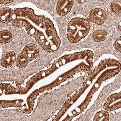 ZNF776 Polyclonal Antibody:Antibodies, Polyclonal