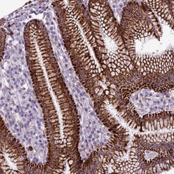 Invitrogen ZNF667 Polyclonal Antibody 100 μL; Unconjugated:Antibodies,