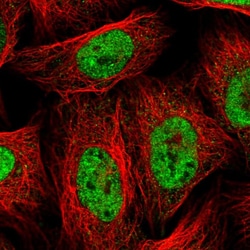 Invitrogen hnRNP AB Polyclonal Antibody 100 &mu;L; Unconjugated:Antibodies,