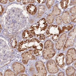 UQCRQ Polyclonal Antibody:Antibodies, Polyclonal