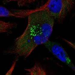 ABCB6 Polyclonal Antibody:Antibodies, Polyclonal