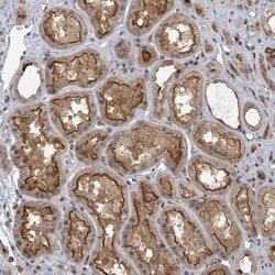 Invitrogen PSMG2 Polyclonal Antibody 100 &mu;L; Unconjugated:Antibodies,