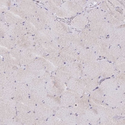 Invitrogen C19orf10 Polyclonal Antibody 100 &mu;L; Unconjugated:Antibodies,