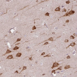 Invitrogen COX18 Polyclonal Antibody 100 &mu;L; Unconjugated:Antibodies,
