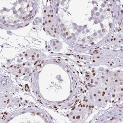 Invitrogen BTBD10 Polyclonal Antibody 100 &mu;L; Unconjugated:Antibodies,