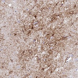 Invitrogen FMN1 Polyclonal Antibody 100 &mu;L | Buy Online | Invitrogen&trade; | Fisher Scientific