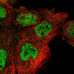 Invitrogen POLR3H Polyclonal Antibody 100 &mu;L; Unconjugated:Antibodies,