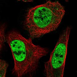 ST5 Polyclonal Antibody:Antibodies, Polyclonal