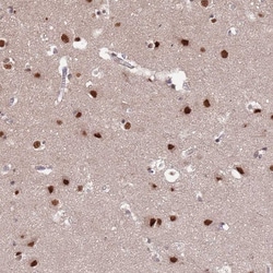 ST5 Polyclonal Antibody:Antibodies, Polyclonal