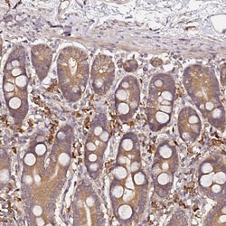 Invitrogen CF136 Polyclonal Antibody 100 &mu;L; Unconjugated:Antibodies,
