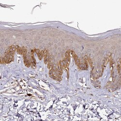 Invitrogen CF136 Polyclonal Antibody 100 &mu;L; Unconjugated:Antibodies,