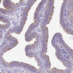 Invitrogen CAPSL Polyclonal Antibody 100 &mu;L; Unconjugated:Antibodies,