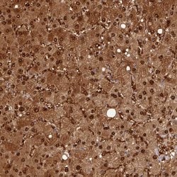 ARL17A Polyclonal Antibody:Antibodies, Polyclonal