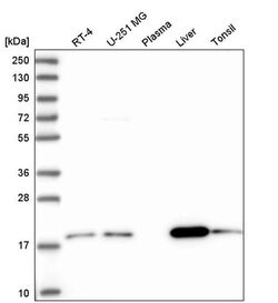 ARL17A Polyclonal Antibody:Antibodies, Polyclonal