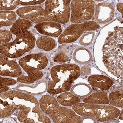 Invitrogen ATAT1 Polyclonal Antibody 100 &mu;L; Unconjugated:Antibodies,