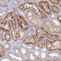 Invitrogen B4GALT4 Polyclonal Antibody 100 &mu;L; Unconjugated:Antibodies,