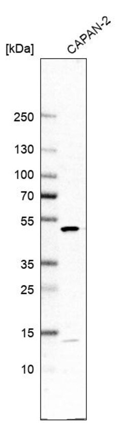 Invitrogen DDOST Polyclonal Antibody 100 &mu;L; Unconjugated:Antibodies,